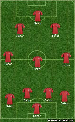 Albania Formation 2010