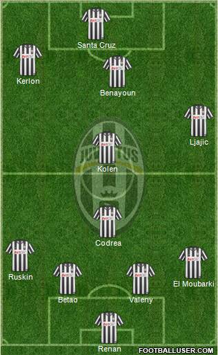 Juventus Formation 2010