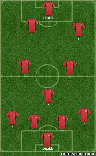 Albania football formation