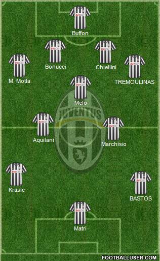 Juventus Formation 2011
