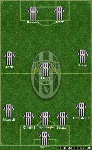 Juventus Formation 2011