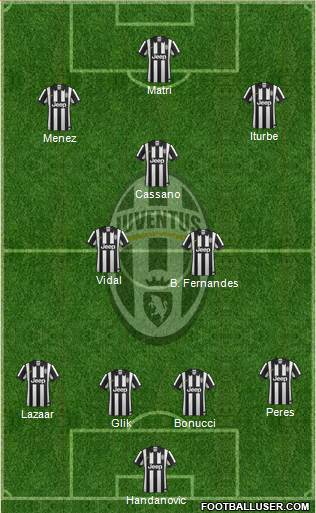 Juventus Formation 2015
