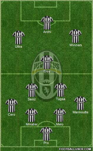 Juventus Formation 2015