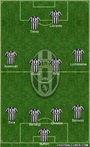 Juventus Formation 2015