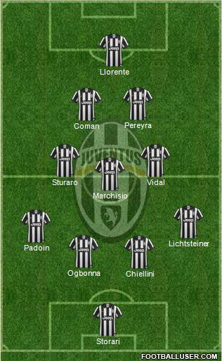 Juventus Formation 2015