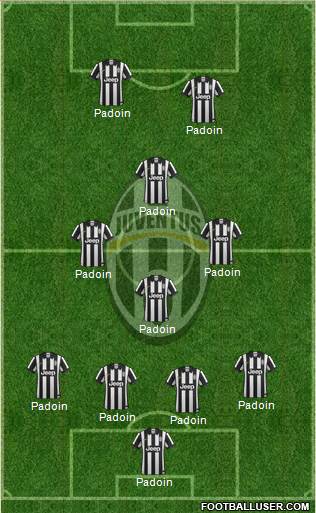Juventus Formation 2015