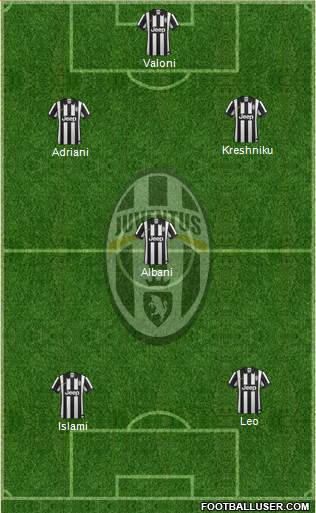 Juventus Formation 2015
