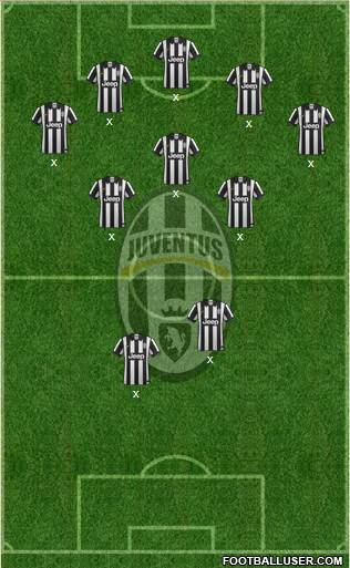 Juventus Formation 2015