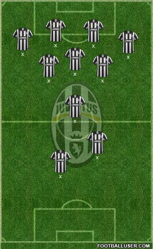 Juventus Formation 2015