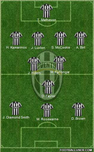 Juventus Formation 2015