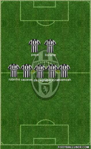 Juventus Formation 2015