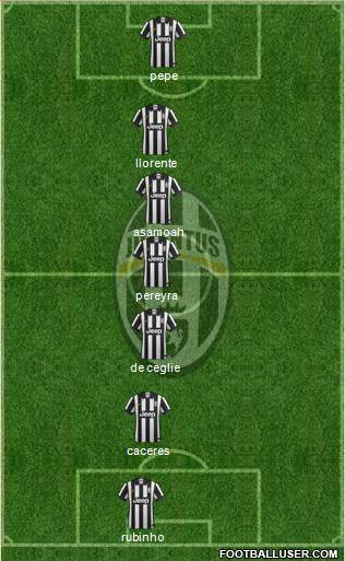 Juventus Formation 2015