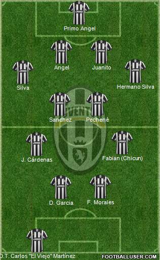Juventus Formation 2015