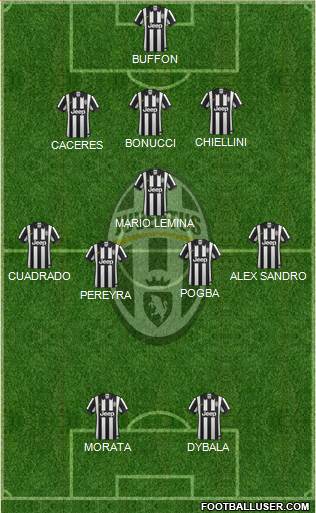 Juventus Formation 2015