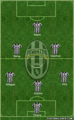 Juventus Formation 2015