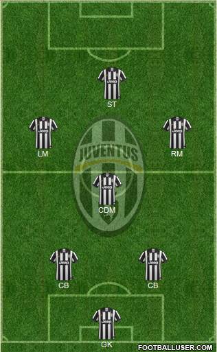 Juventus Formation 2015