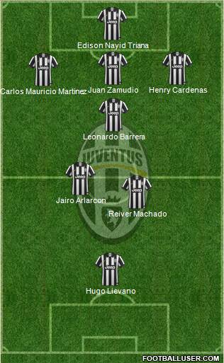 Juventus Formation 2015