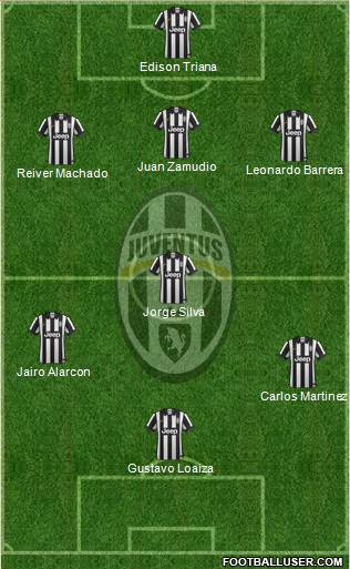 Juventus Formation 2015