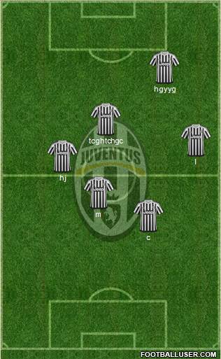Juventus Formation 2015