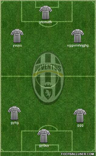 Juventus Formation 2015