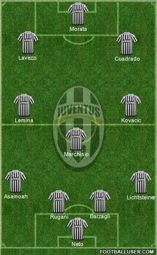 Juventus Formation 2015