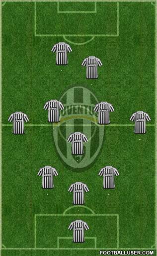 Juventus Formation 2016