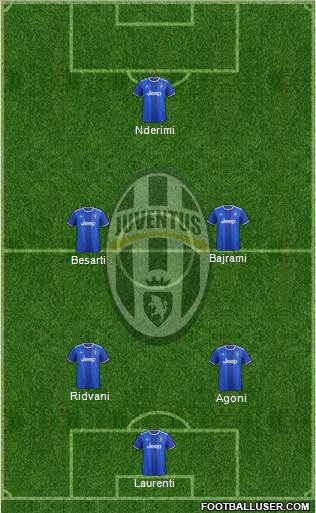 Juventus Formation 2017