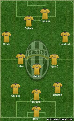 Juventus Formation 2018