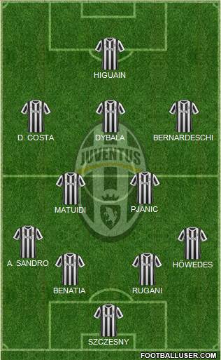 Juventus Formation 2018