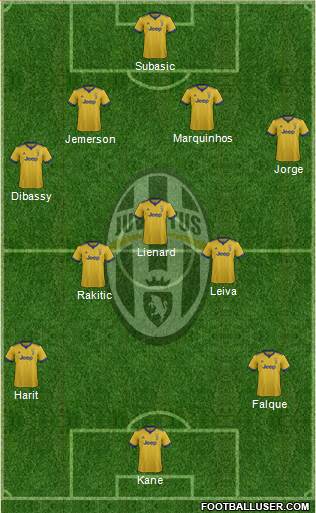 Juventus Formation 2018