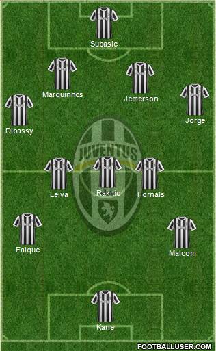 Juventus Formation 2018