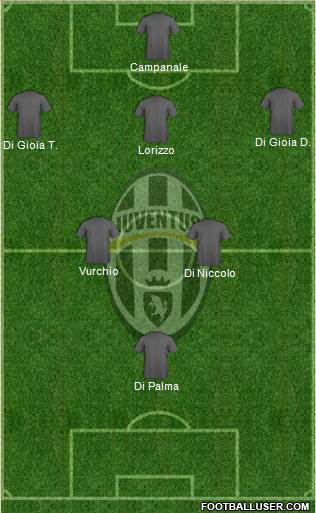 Juventus Formation 2018