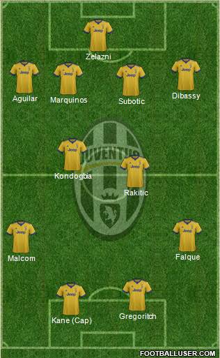 Juventus Formation 2018