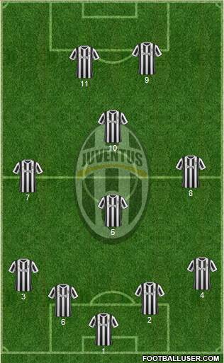 Juventus Formation 2018