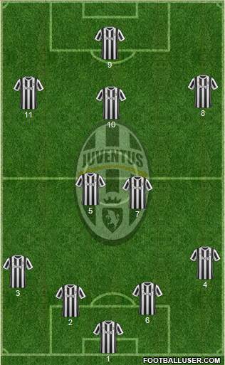 Juventus Formation 2018
