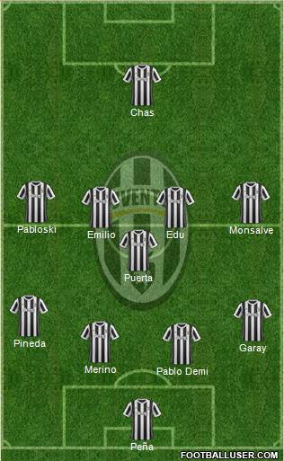 Juventus Formation 2018