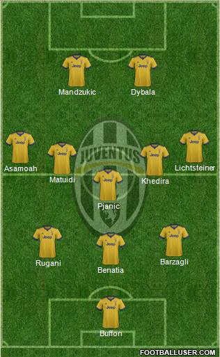 Juventus Formation 2018