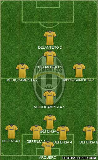Juventus Formation 2018