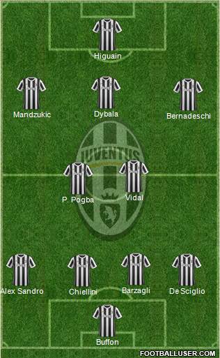 Juventus Formation 2018