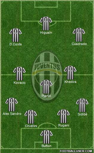 Juventus Formation 2018