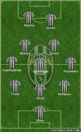 Juventus Formation 2018