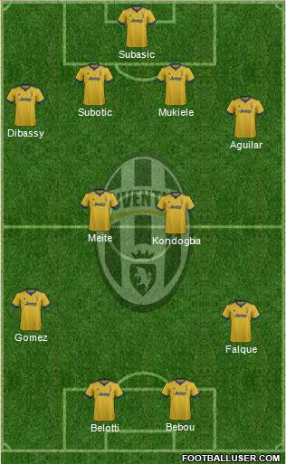 Juventus Formation 2018