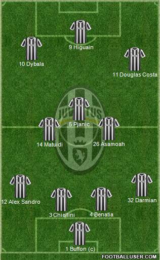 Juventus Formation 2018