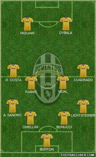 Juventus Formation 2018