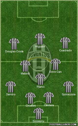 Juventus Formation 2018