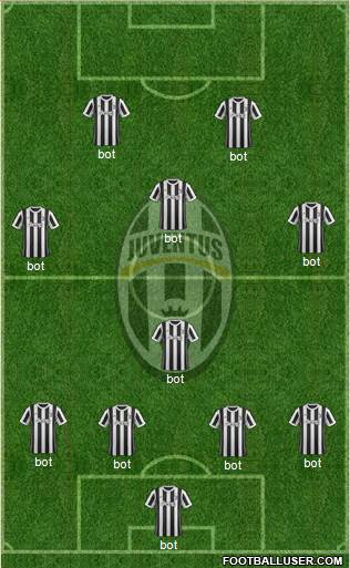 Juventus Formation 2018