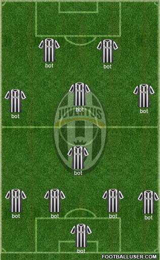 Juventus Formation 2018