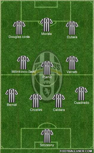 Juventus Formation 2018