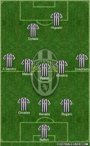 Juventus Formation 2018
