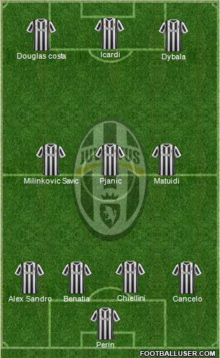 Juventus Formation 2018